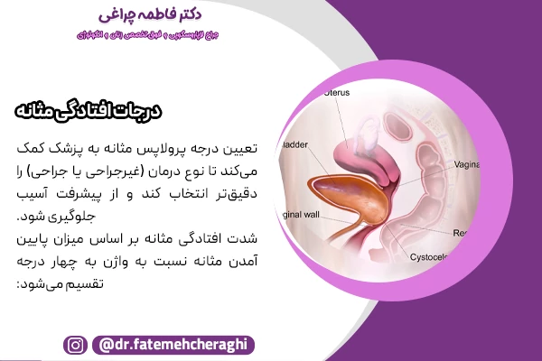 در درجه اول افتادگی مثانه، جابه‌جایی خفیف بوده، در درجه دوم، مثانه تا نزدیکی دهانه واژن پایین می‌آید، در درجه سوم، بخشی از مثانه از واژن بیرون می‌زند و در درجه چهارم تمام دیواره مثانه خارج می‌شود که به آن پرولاپس کامل مثانه گفته می‌شود.