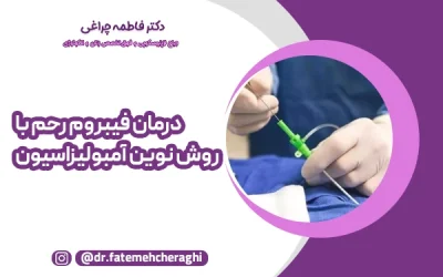درمان فیبروم رحم با روش نوین آمبولیزاسیون