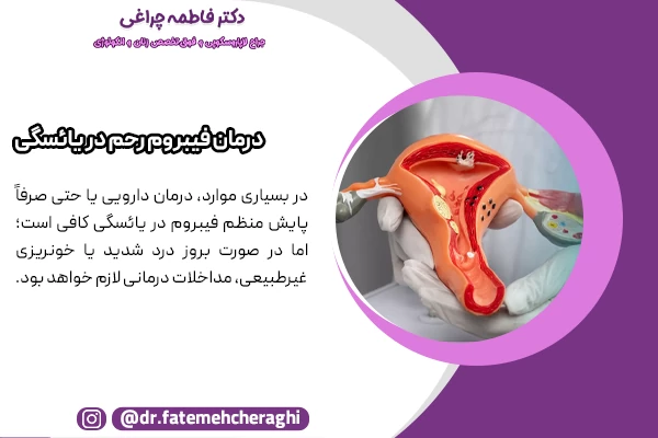 نیاز به درمان فیبروم حتی پس از قاعدگی نیز وجود دارد.