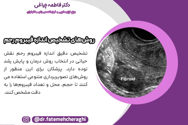 سونوگرافی و MRI از جمله روش هایی هستند که جهت تشخیص اندازه فیبروم در رحم استفاده میشود