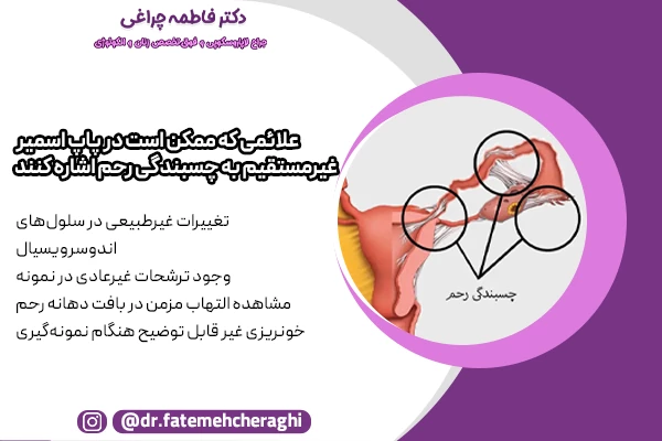 تغییرات غیرطبیعی در سلول‌های اندوسرویسیال، وجود ترشحات غیرعادی در نمونه، مشاهده التهاب مزمن در بافت دهانه رحم و خونریزی غیر قابل توضیح هنگام نمونه‌گیری از جمله علائم غیر مستقیم چسبندگی رحم در پاپ اسمیر محسوب میشوند