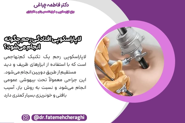 لاپاراسکوپی افتادگی رحم با استفاده از ابزارهای ظریف و دید مستقیم از طریق دوربین انجام می‌شود