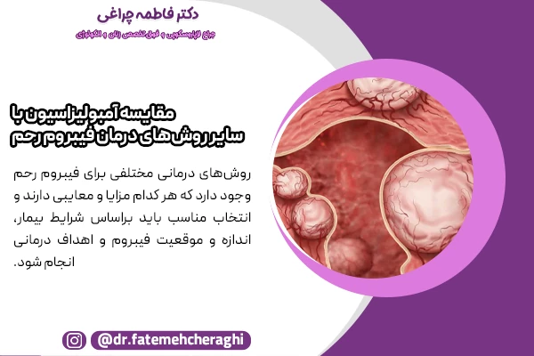 مقایسه آمبولیزاسیون با لاپاراسکوپی و دیگر روش های درمان فیبروم رحم
