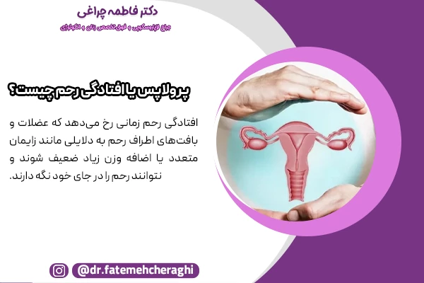 افتادگی رحم زمانی رخ می‌دهد که عضلات و بافت‌های اطراف رحم نتوانند رحم را در جای خود نگه دارند.