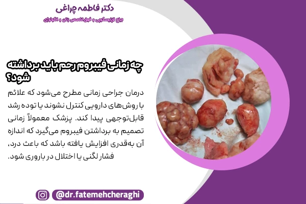 برداشتن فیبروم رحم زمانی مطرح می‌شود که علائم با روش‌های دارویی کنترل نشوند یا توده رشد قابل‌توجهی پیدا کند
