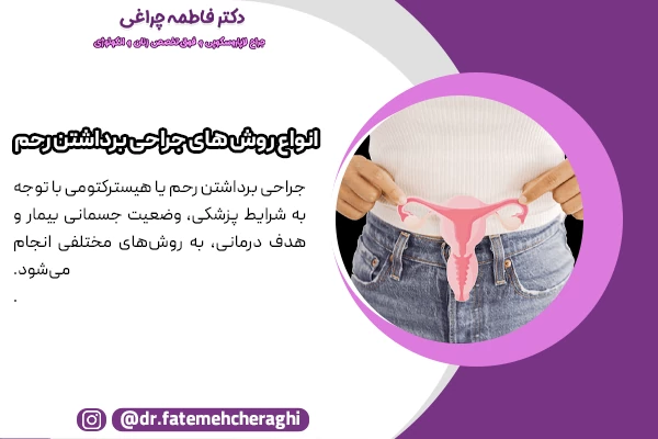 برداشتن رحم با لاپاراسکوپی، از طریق واژن و از راه شکم از جمله متد های انجام جراحی هیسترکتومی محسوب میشوند