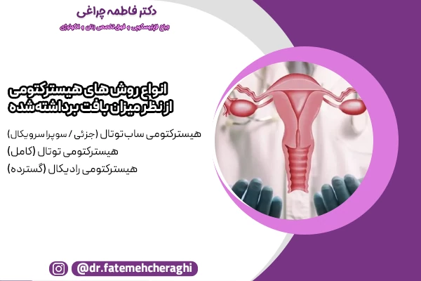هیسترکتومی های ساب‌توتال (جزئی)، توتال (کامل) و  رادیکال (گسترده)؛ روش های عمل برداشتن رحم