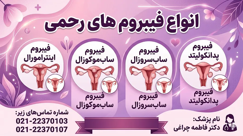 انواع فیبروم های رحمی