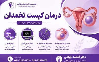 درمان کیست تخمدان | راه درمان کیست تخمدان